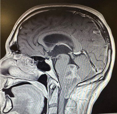 Skull Base Surgery: Anatomy, Approaches & Innovations